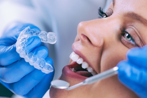 Şeffaf Plakla Ortodontik Tedavi | Dent Elitium
